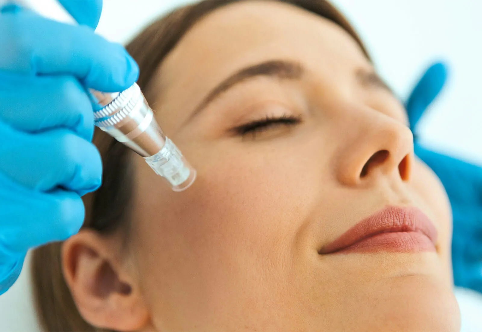 Mesoterapia Facial: La Revolución de la Belleza en Córdoba