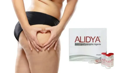 Revolutionizing Beauty: Alidya y Mesoterapia Corporal