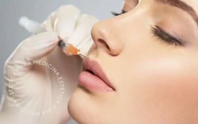 Hilos Tensores para Elevar el Rostro: La Técnica Más Innovadora en Rejuvenecimiento
